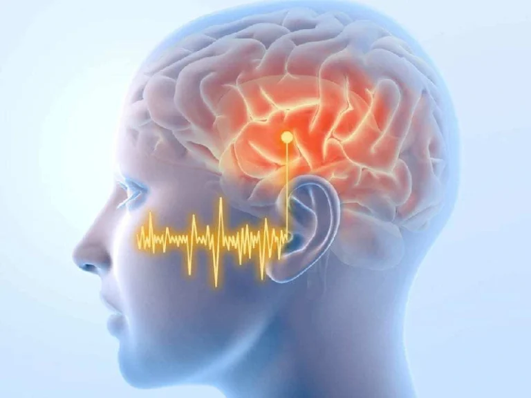 Sound Therapy Treatment for Tinnitus