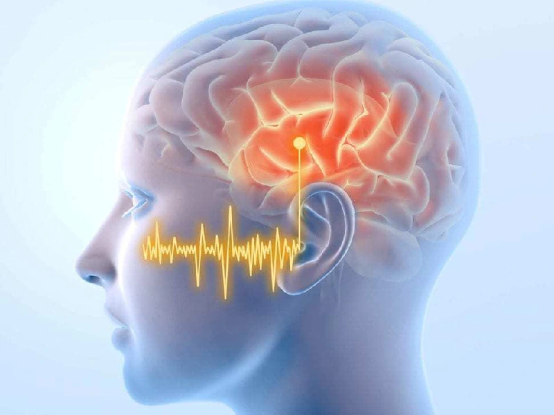 Sound Therapy Treatment for Tinnitus