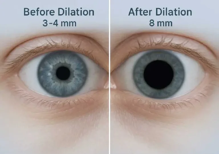 How Long Does Eye Dilation Last