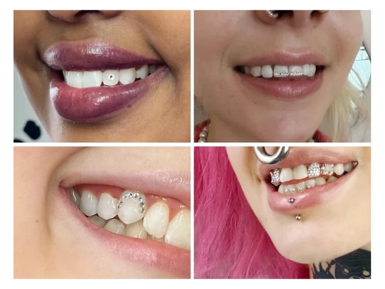 Tooth Gems High Fashion