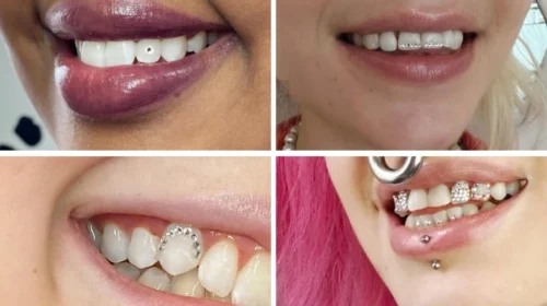 Tooth Gems High Fashion