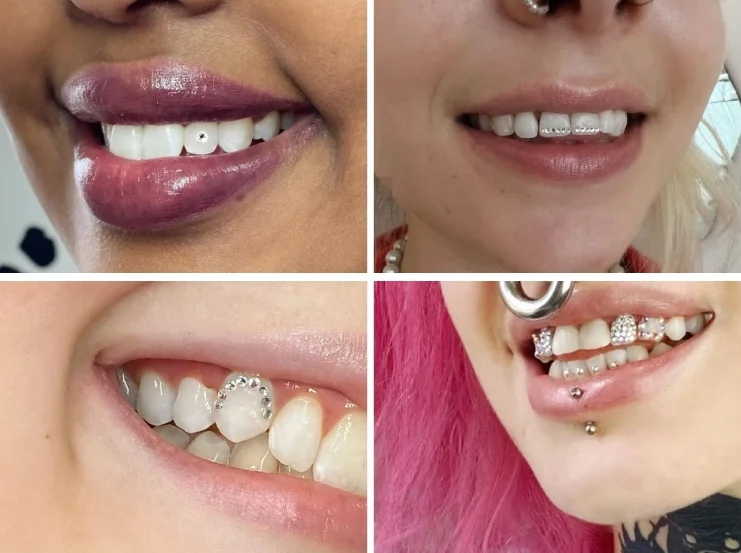 Tooth Gems High Fashion